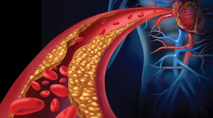 Soffri di ipertensione? cibi da assumere e da evitare